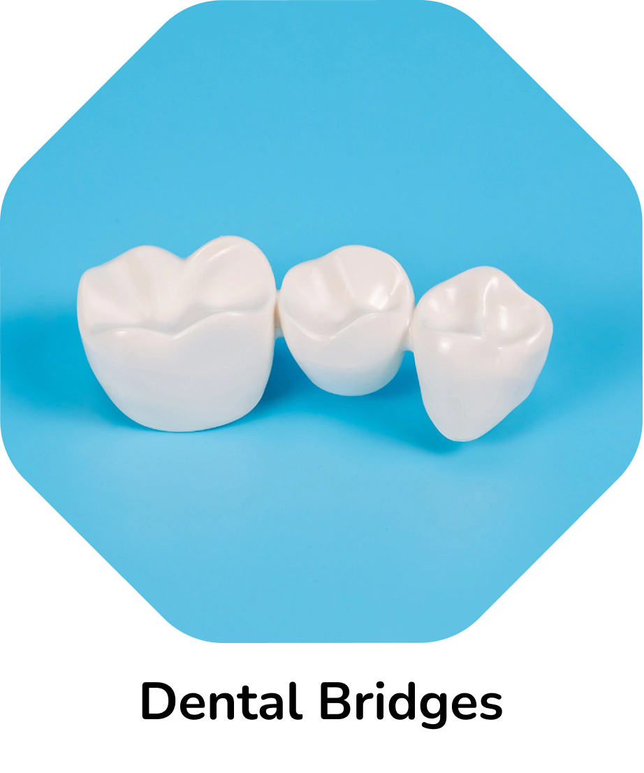 Dental Bridges – three-unit white dental bridge on a blue background